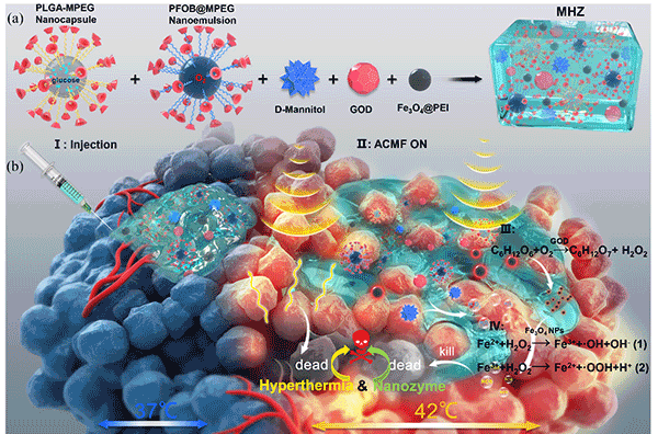 可注射超分子磁性水凝胶：磁热纳米酶携手治疗肿瘤