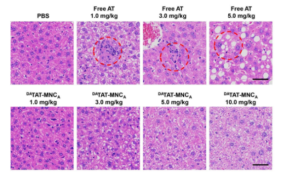 【文献速递】磁性/TAT双靶向递送艾乐替尼的纳米载体实现非小细胞肺癌治疗增效减毒